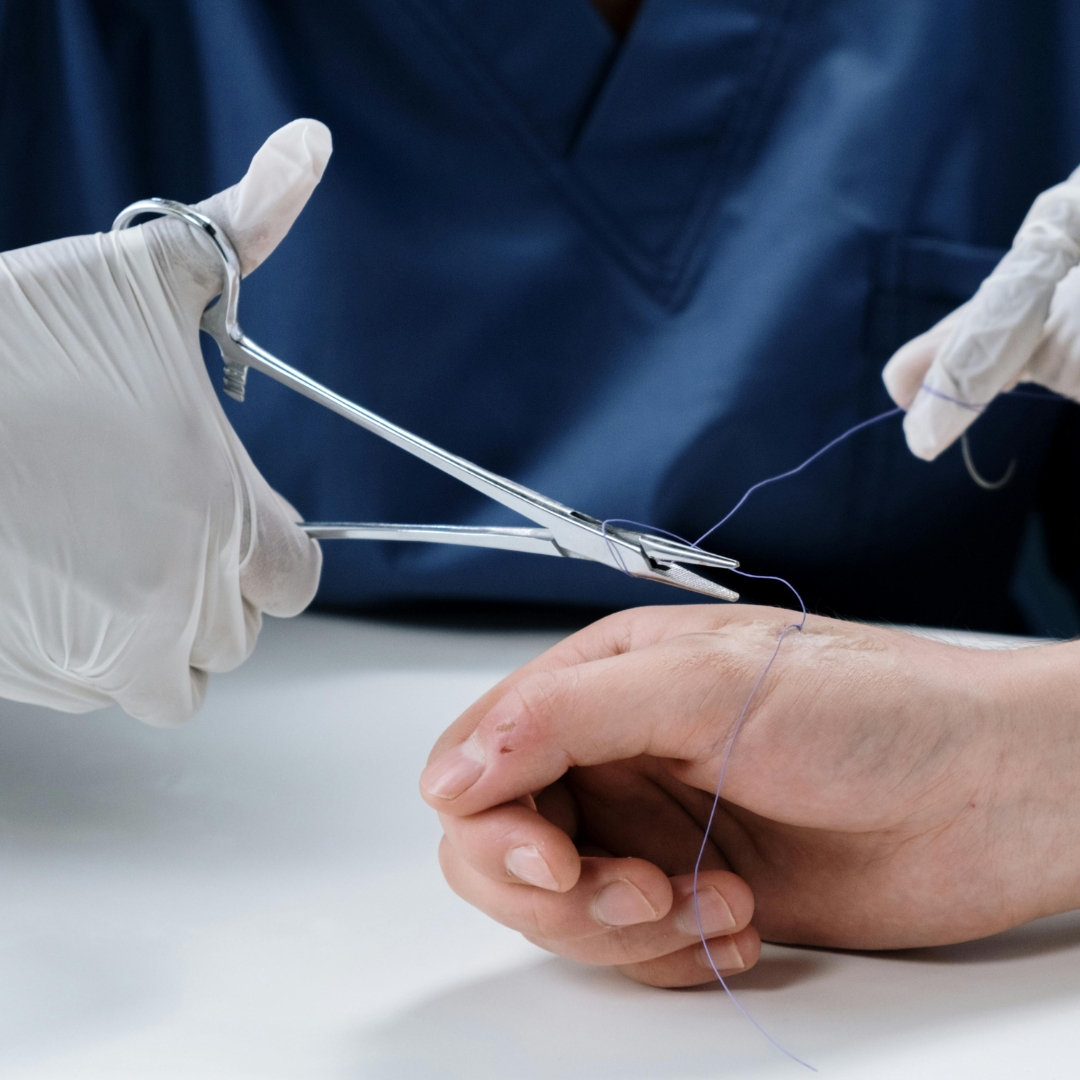 Suturas: Técnicas e Cuidados Essenciais