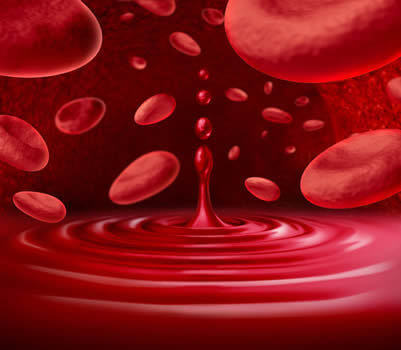 Anemia Falciforme