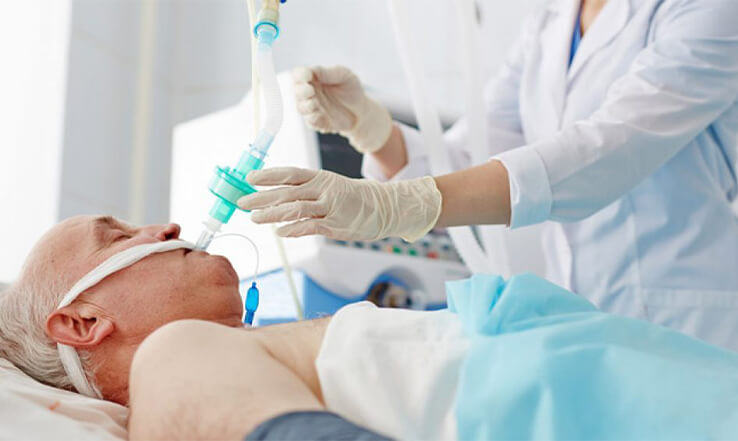  Ventilação Mecânica 