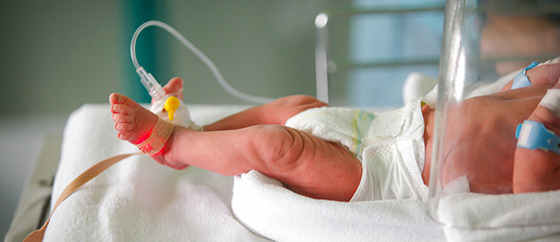  Acesso Venoso Neonatal