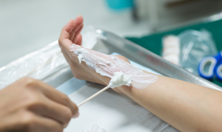 Assistência De Enfermagem Ao Paciente Queimado
