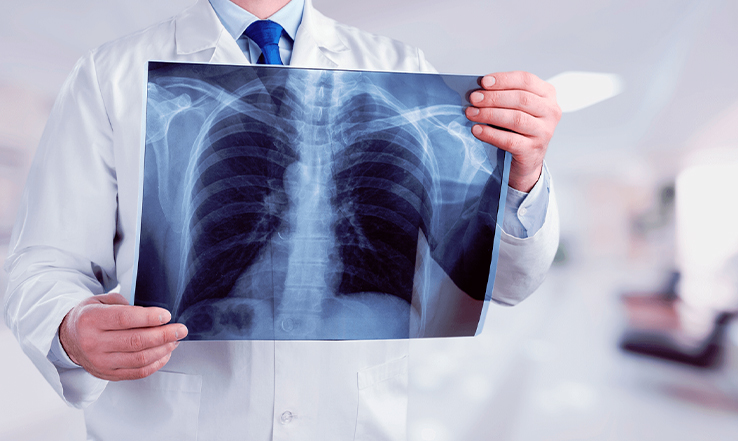 Radiologia E Análise De Imagens