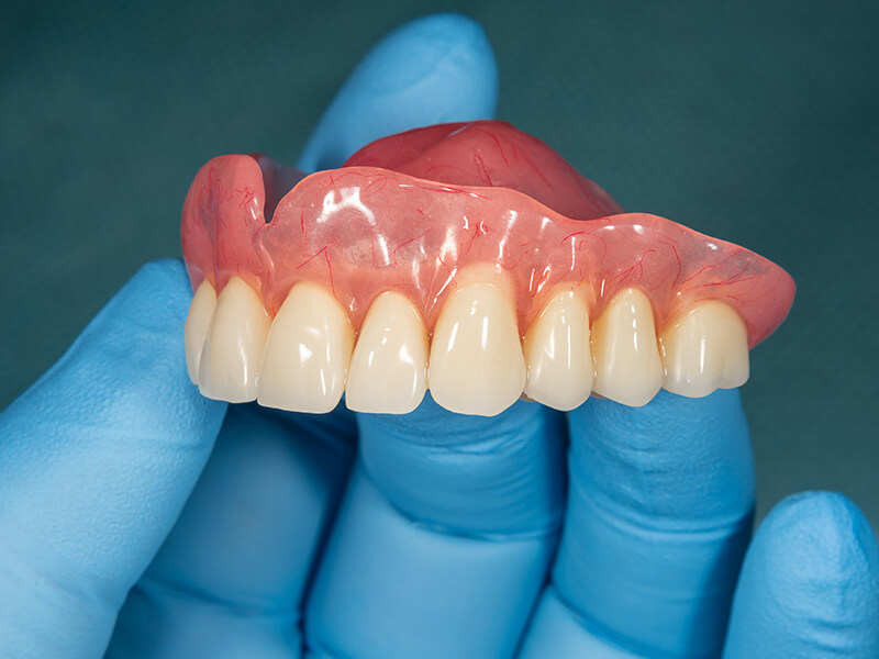 Prótese Dentária